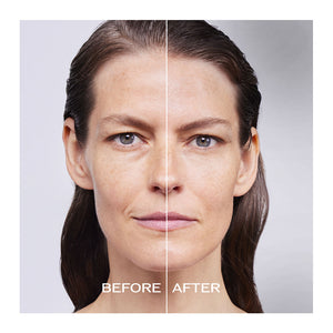 Bio Filler