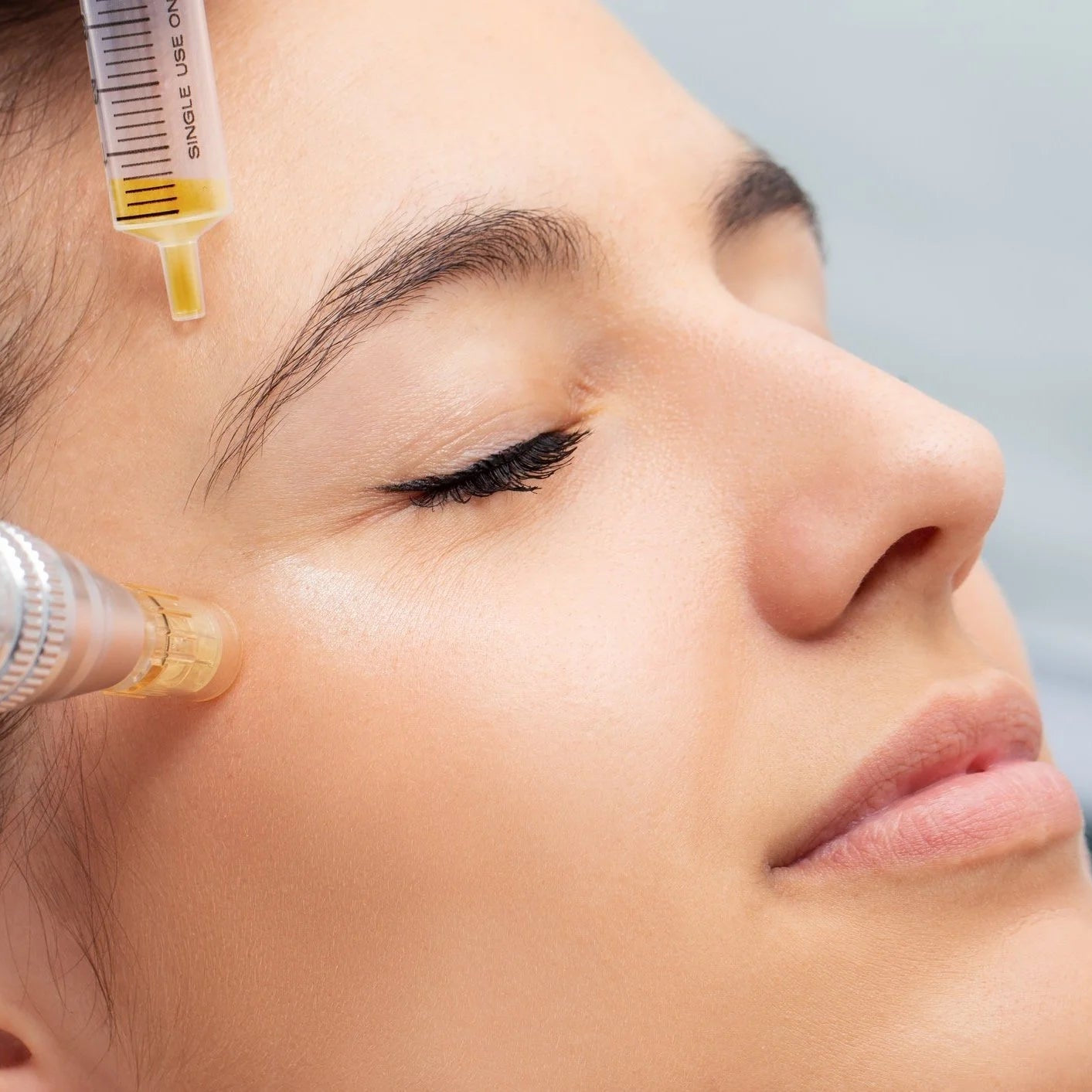 PRP (Platelet-Rich Plasma)